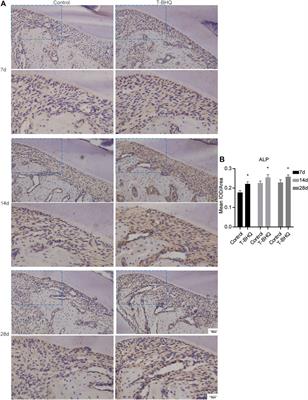 Nrf2 Activation Is Involved in Cyclic Mechanical Stress-Stimulated Osteogenic Differentiation in Periodontal Ligament Stem Cells via PI3K/Akt Signaling and HO1-SOD2 Interaction